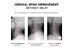 3D Smart Cervical Massager 9 Intensity 6 Modes Neck Massager