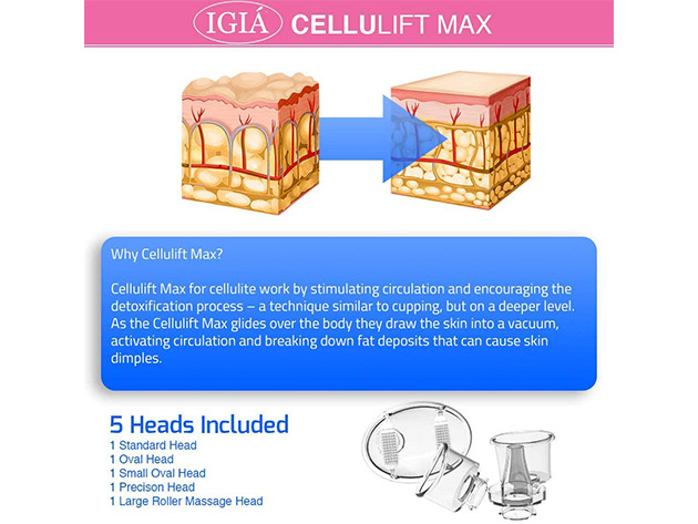 IGIA Cellulift Max: Anti-Cellulite Suction Massager