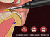Smart Wireless Ear Otoscope